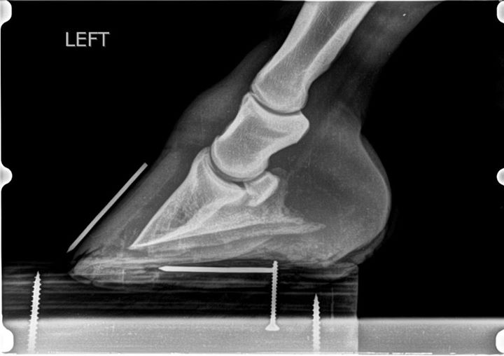 Radiografia